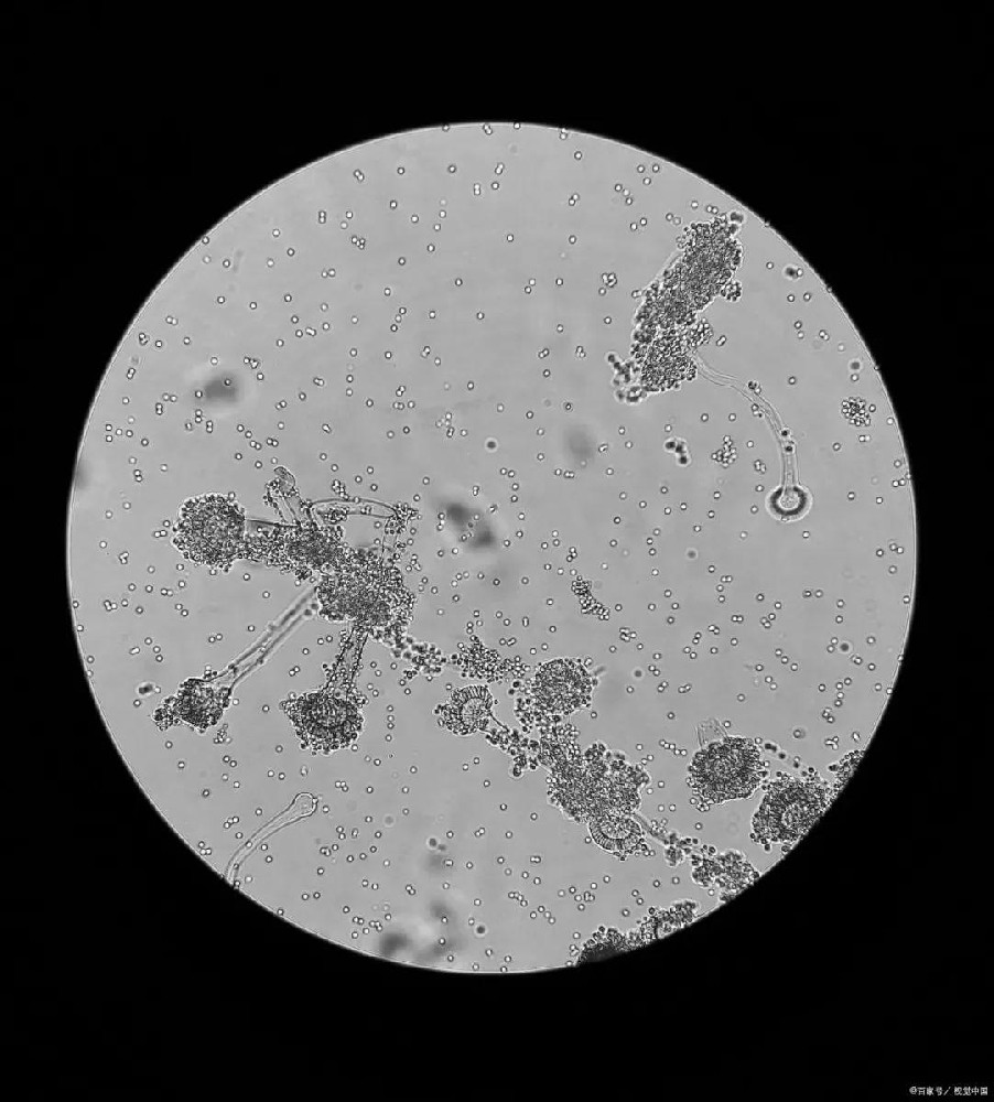 ?如何進(jìn)一步提高微生物菌群的活性和多樣性？